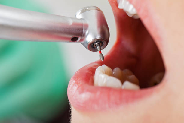 Best Emergency Dental Care for Sports Injuries in Lake Nacimiento, CA